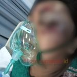 Teks foto : Korban KA alami luka lebam, saat dirawat di RSUD Sidoarjo.(ist)