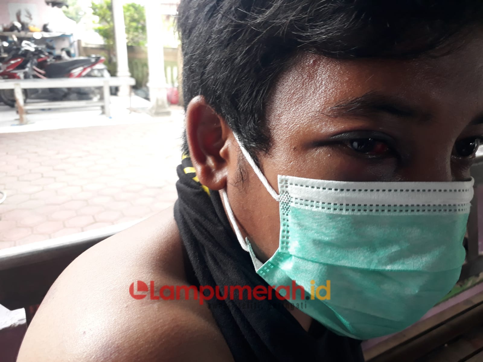 Teks foto : korban Muhammad Nur Ilham mengalami luka-luka (ist)
