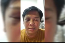 6 Bulan Tanpa Ditahan, Kuasa Hukum Soroti Kasus Penganiayaan Oleh Oknum DPRD